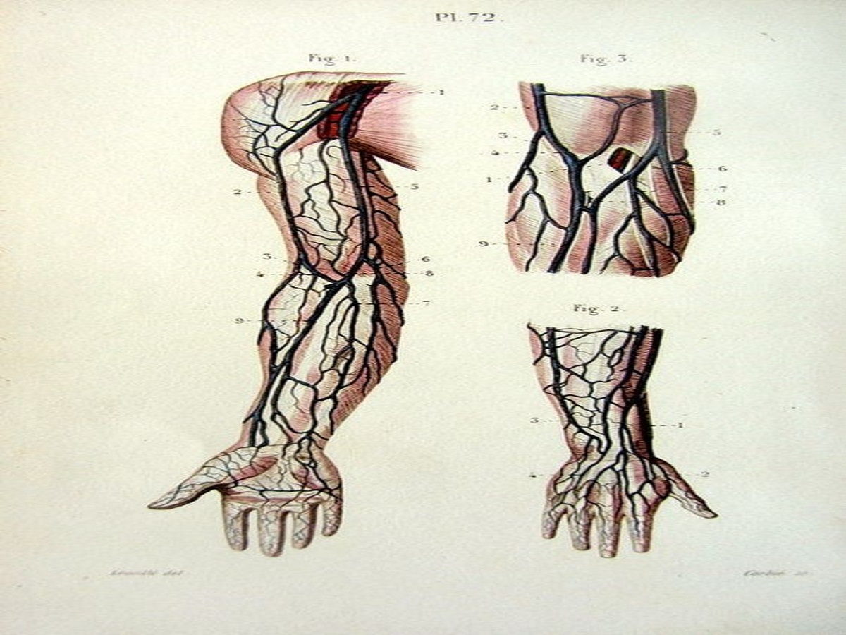 Blockage in the veins of the body: शरीर की नसों में ब्लॉकेज - Photo Gallery