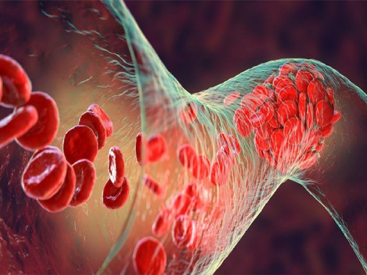 7 Benefits If Drinking Green Tea In Morning: सुबह ग्रीन- टी पीने के ये 7 फायदे , जो आपके चेहरे को बनऐगा चमकदार - Photo Gallery