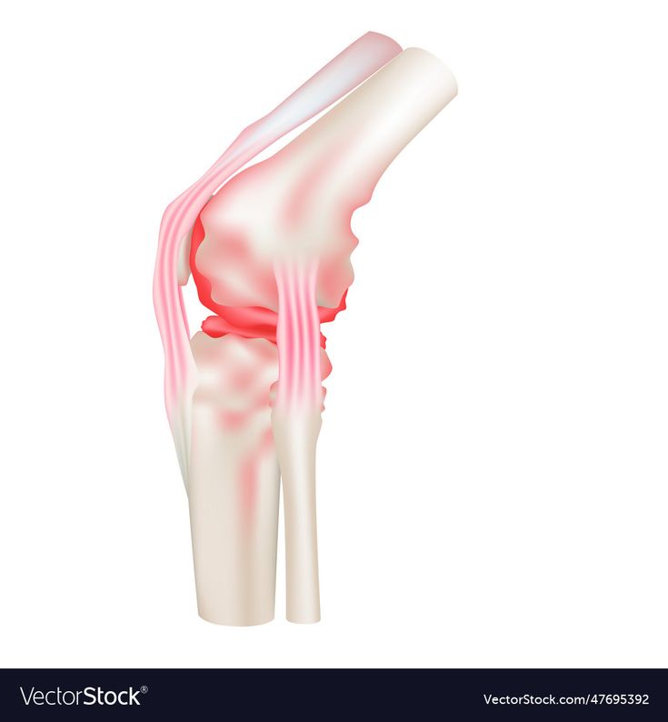 “Painful Knees During Movement: चलते समय घुटनों में दर्द क्यों होता है? कारण, लक्षण और समाधान - Photo Gallery