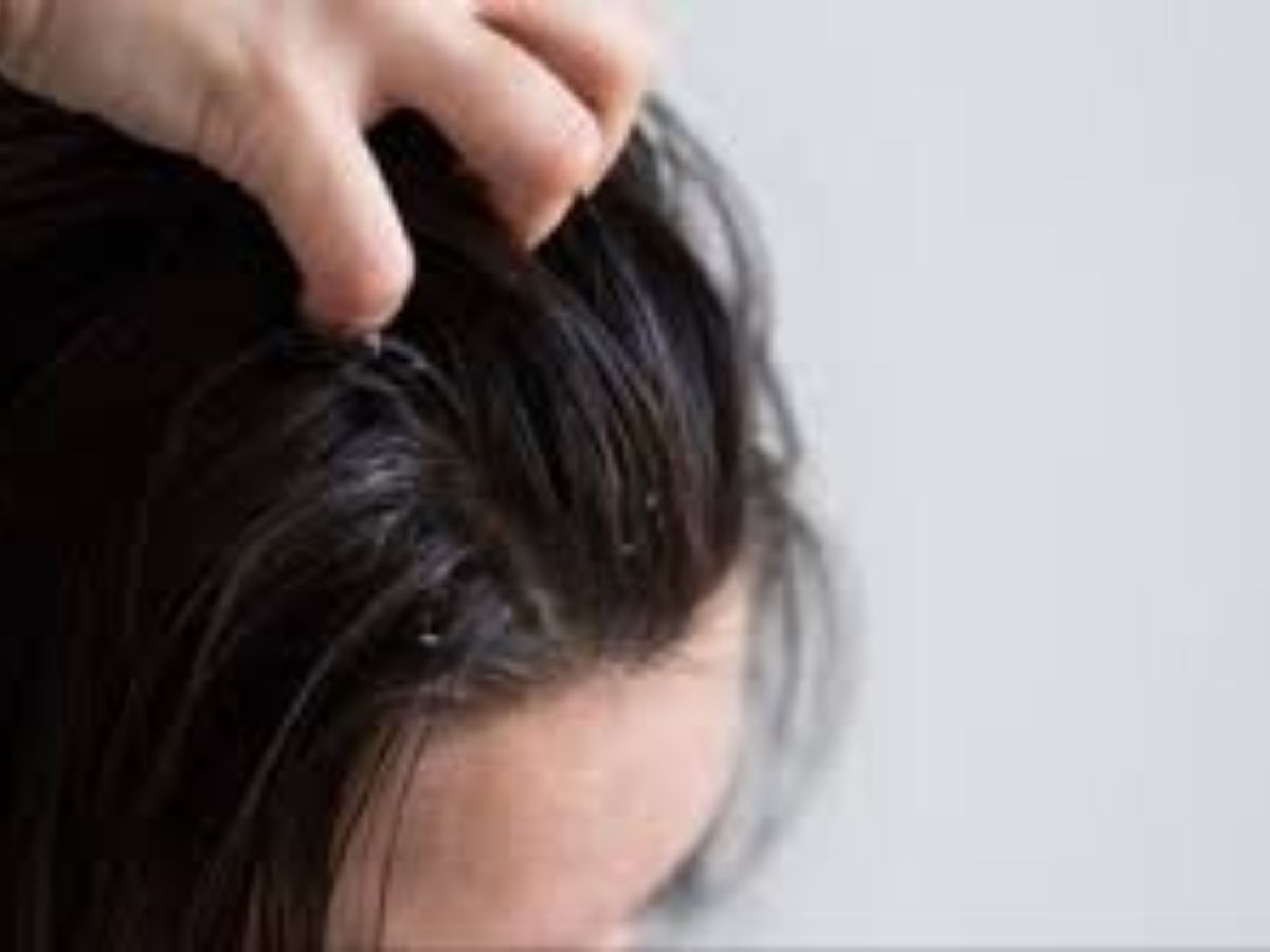 क्या कैस्टर ऑयल से बढ़ती है बालों की लंबाई? जानें 7 बड़े फायदे - Photo Gallery