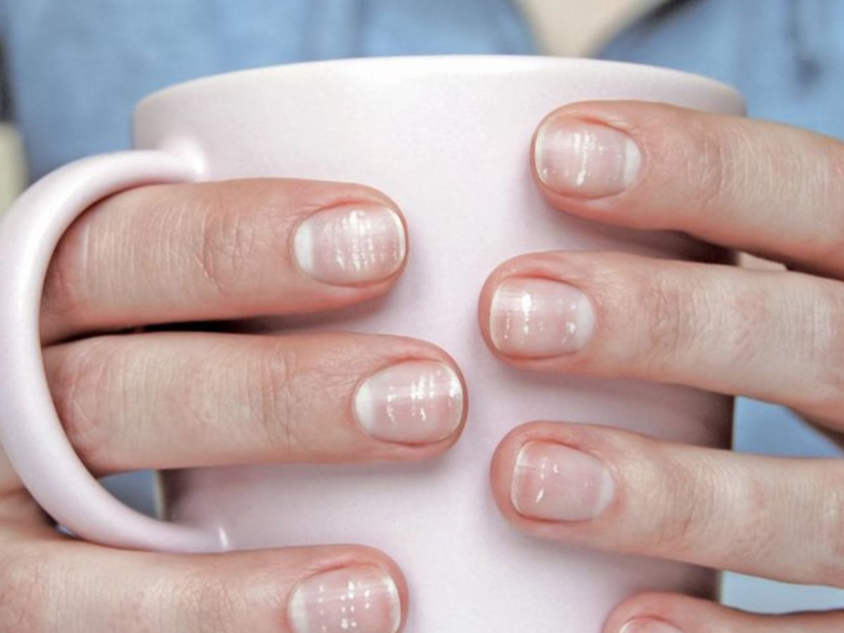 White Spot Meaning: नाखूनों पर सफेद दाग-धब्बे दिखने के पीछे क्या कारण होते है? - Photo Gallery