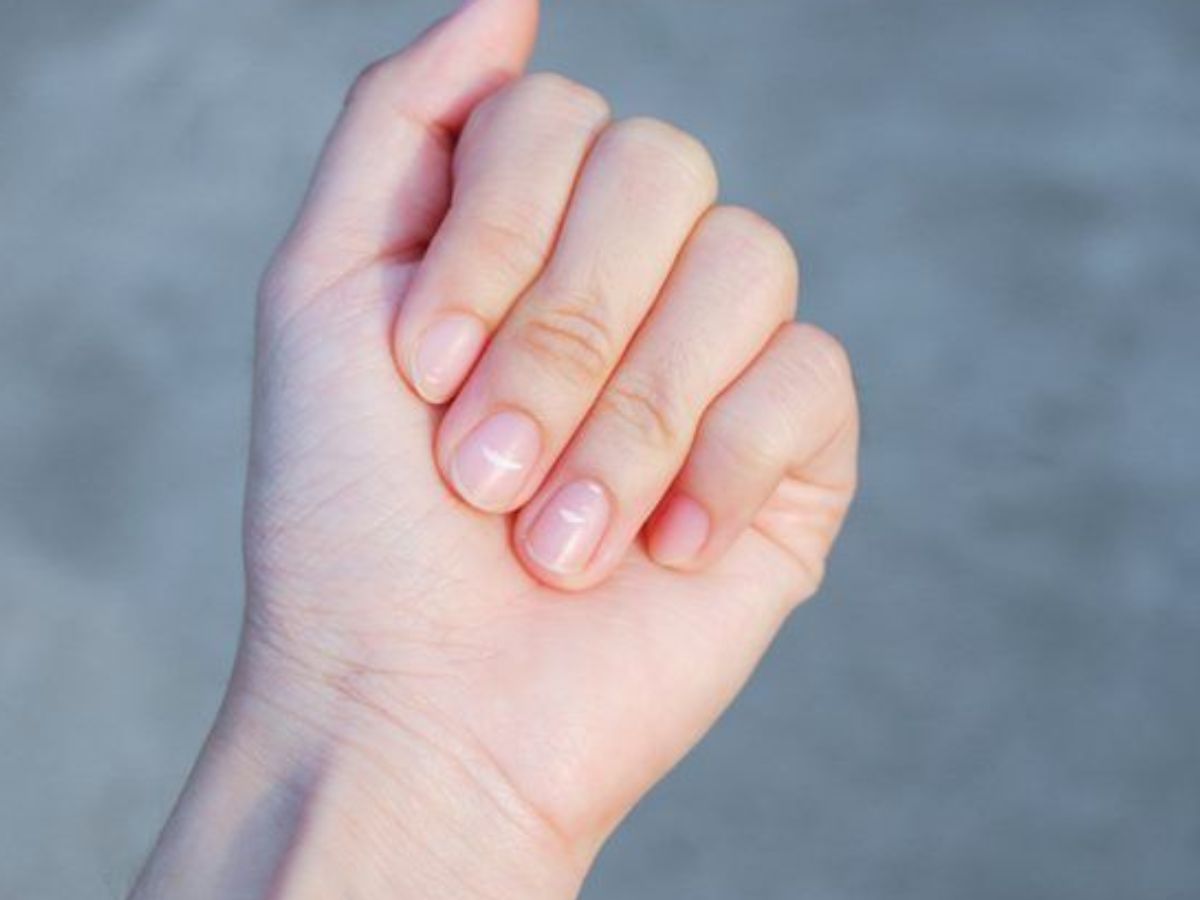 White Spot Meaning: नाखूनों पर सफेद दाग-धब्बे दिखने के पीछे क्या कारण होते है? - Photo Gallery