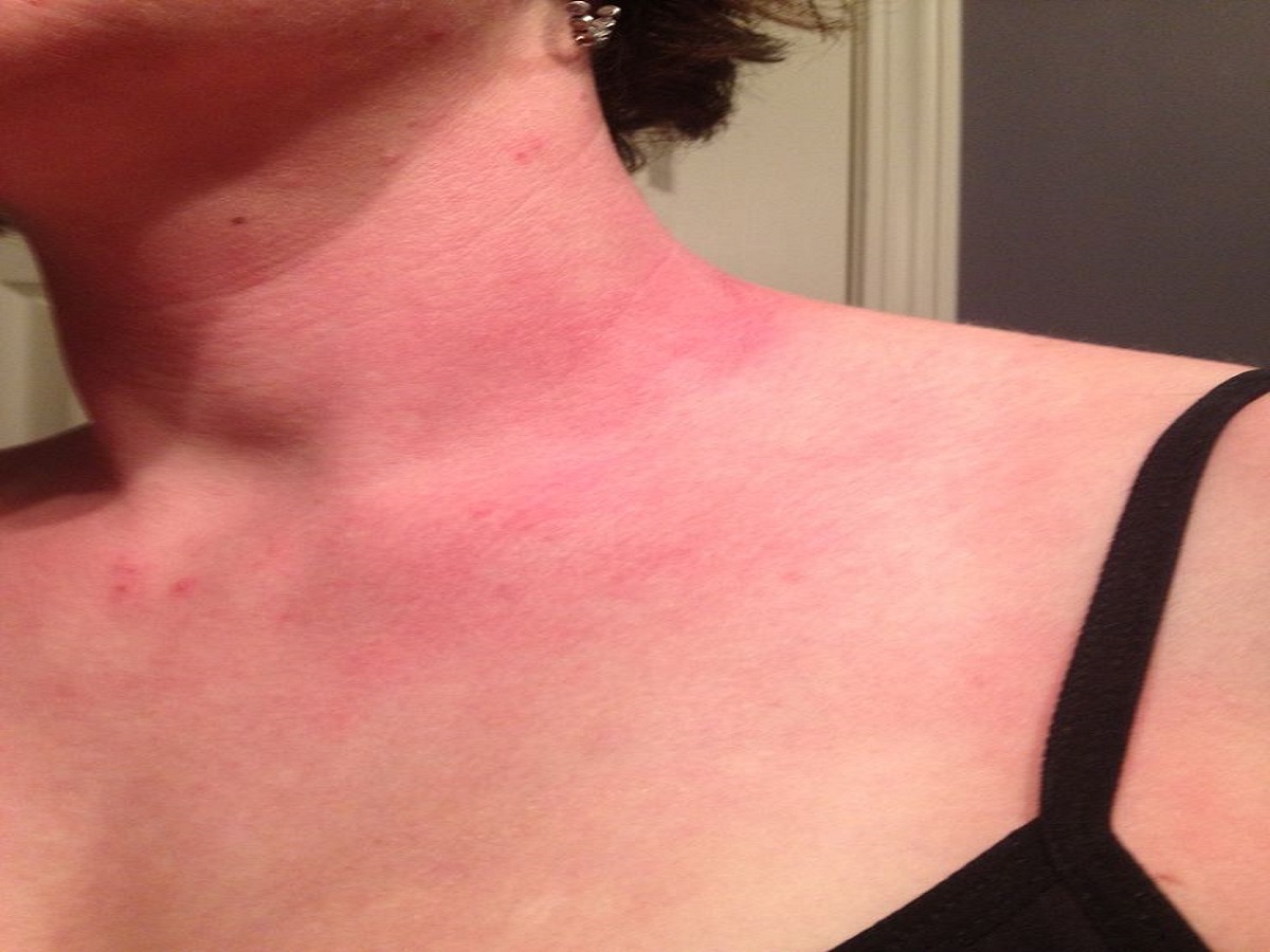 10 Disadvantage Of Tattoo: अगर आप भी हैं टैटूज के शोकीन तो हो जाइए सावधान, हो सकते हैं यें नुकसान - Photo Gallery