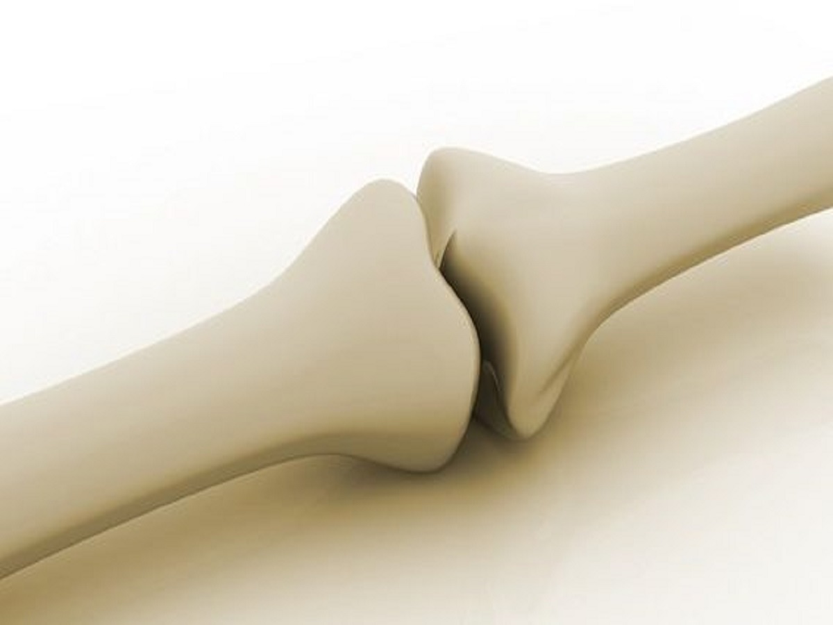 “Painful Knees During Movement: चलते समय घुटनों में दर्द क्यों होता है? कारण, लक्षण और समाधान - Photo Gallery