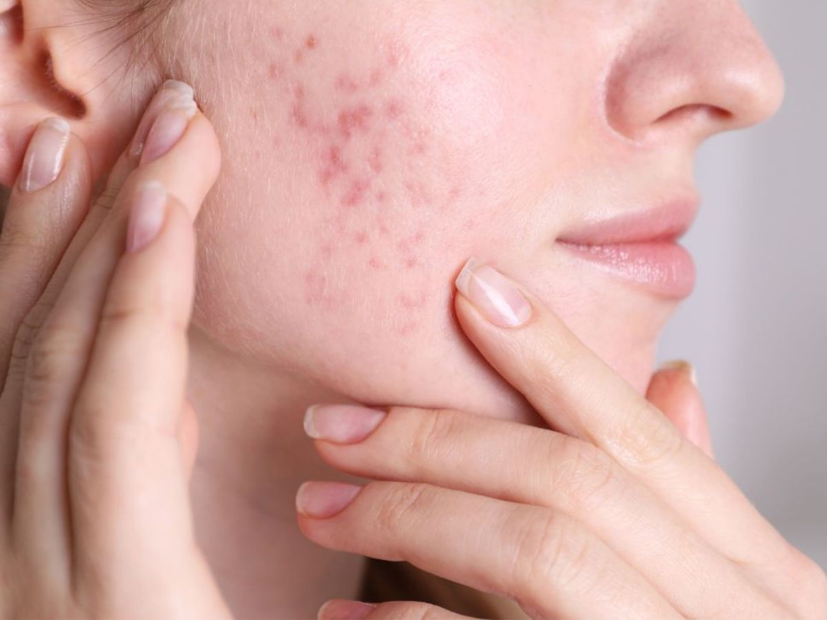 जानें बर्थ कंट्रोल गोलियों के बारे में कुछ ख़ास बातें, क्या आपकी सेहत को हैं इससे खतरा ? - Photo Gallery