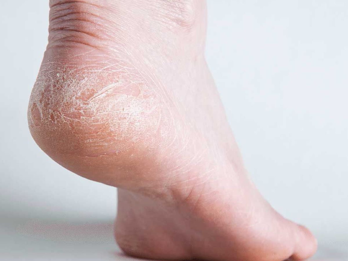 क्या आपको पता हैं? शरीर के इन अंगों को भी होती हैं सफाई की जरूरत - Photo Gallery