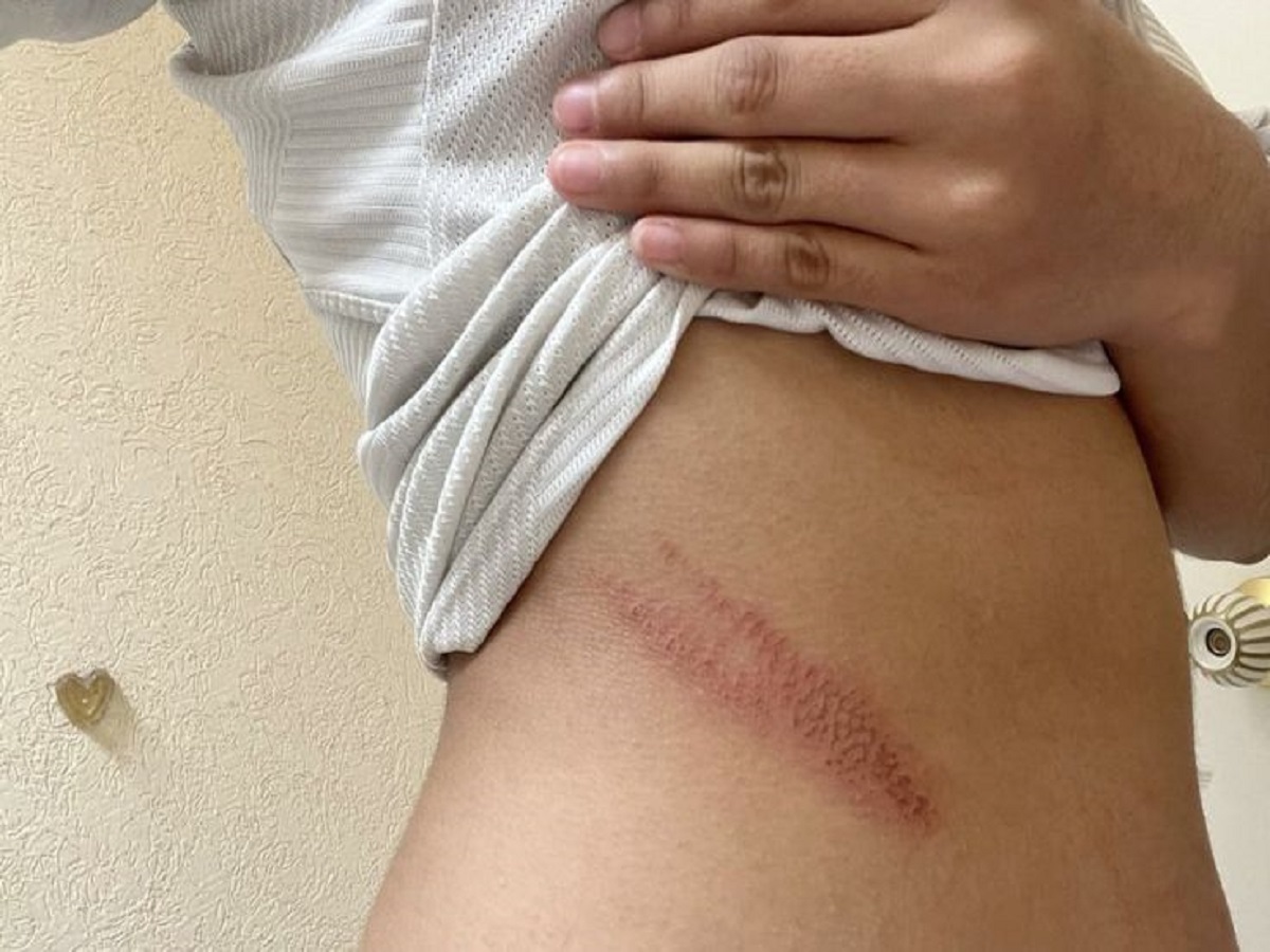 Benefits Of Cinnamon: जानें दालचीनी से जुड़े ये कुछ फायदे, रखेंगे इम्यूनिटी स्ट्रॉग और स्किन का ख्याल - Photo Gallery