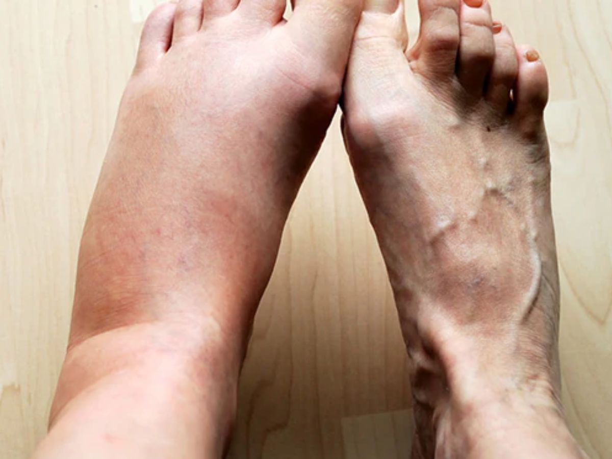 Summers 2025: Flax Seeds के कुछ ऐसे फ़ाइड, जो रखे आपको इस summer हेल्थी एंड फिट। - Photo Gallery