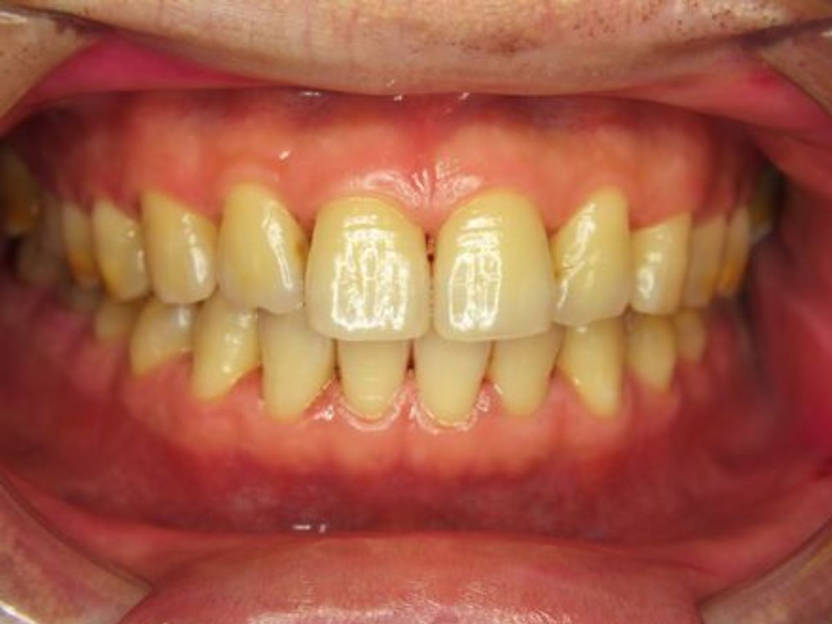 क्या आपको भी जानना है सफेद मुस्कान का सीक्रेट ? तो समाधान सिर्फ खानपान की ही नहीं बल्कि है विटामिन की ड़ोज भी - Photo Gallery