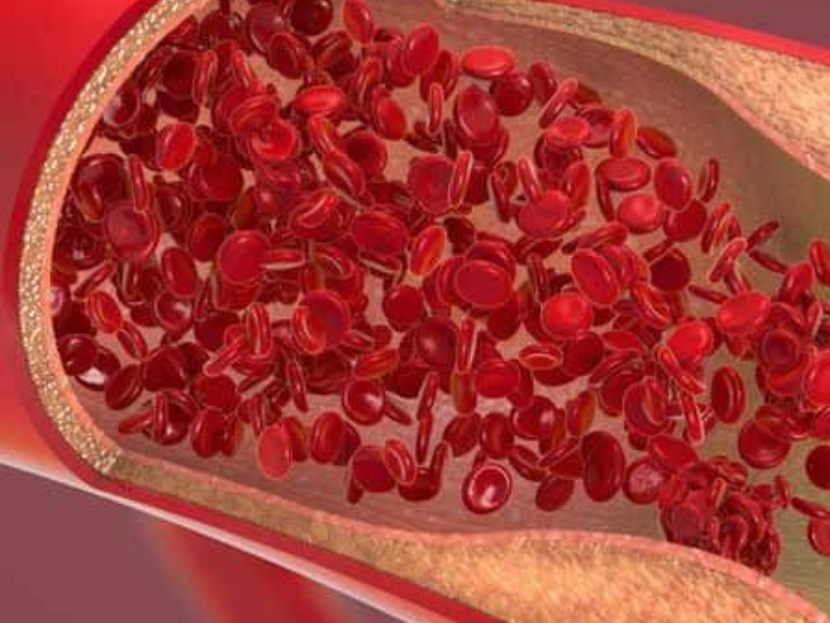 जानिए हल्दी में छुपे राज , जो बदल देंगे आपके सेहत के नजरिए को - Photo Gallery