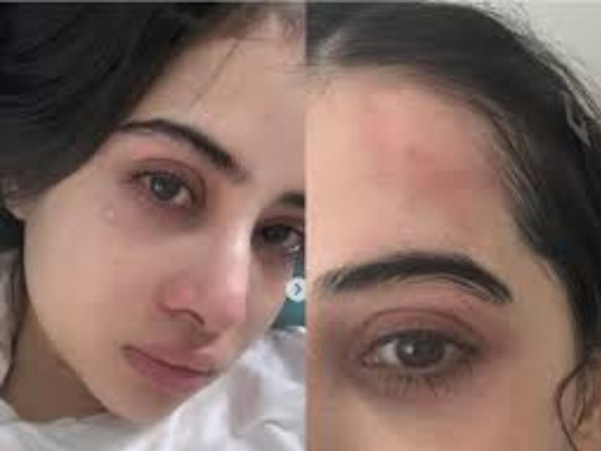 माथे पर चोट, आंखों में आंसू, Urfi Javed की ऐसी हालत देखकर सहम गए फैंस, क्या हुआ ऐसा? - Photo Gallery