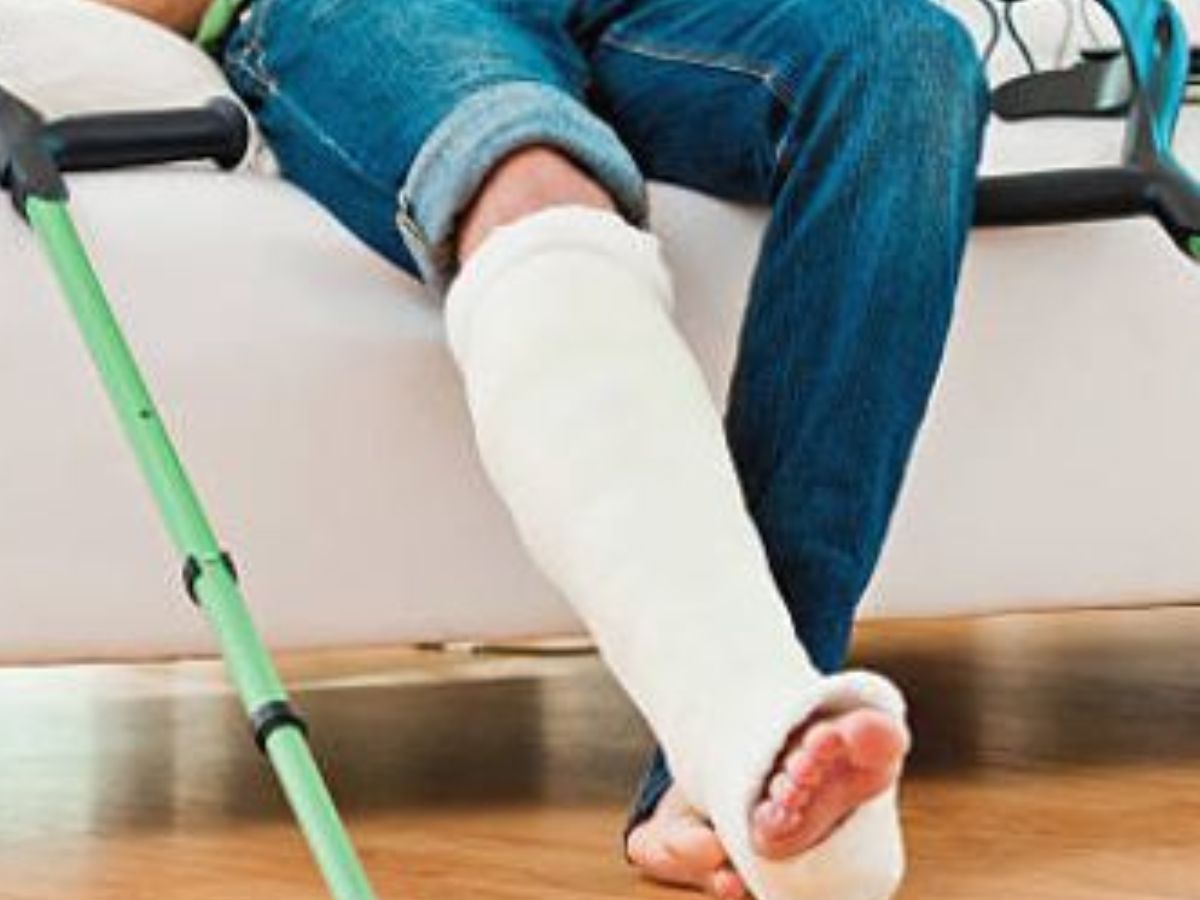 Weak bones and fractures - Photo Gallery