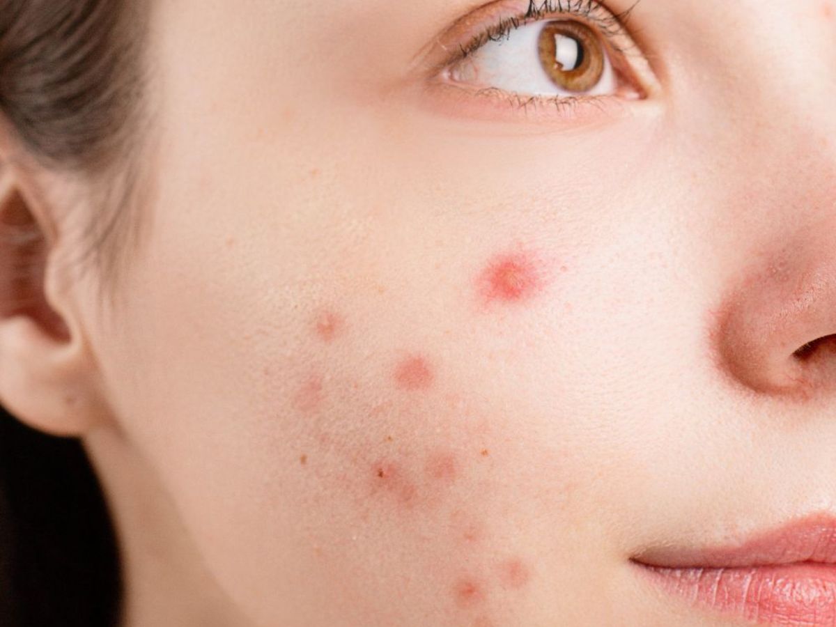 Tamannaah Bhatia Viral Beauty Hack - Photo Gallery