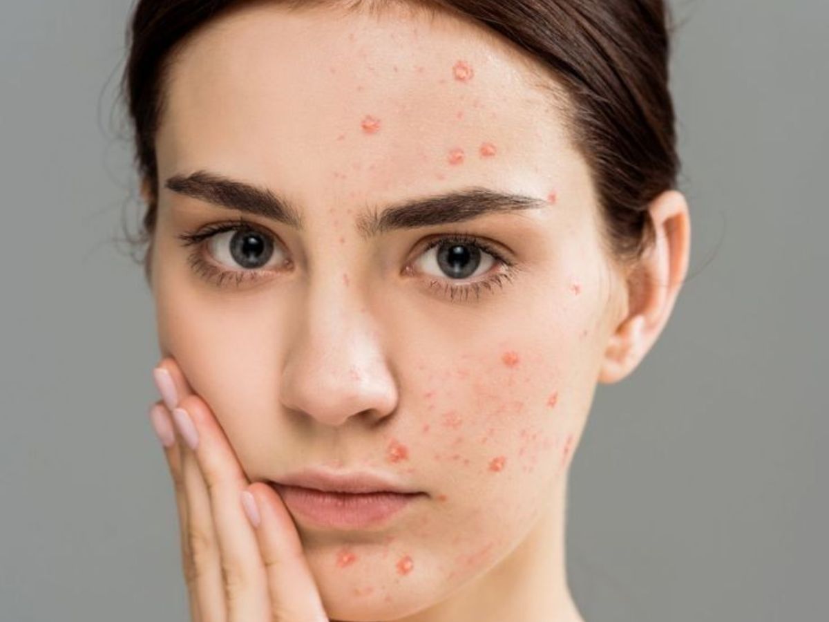 क्या सचमुच बासी थूक से ठीक होते हैं पिंपल्स? जाने Tamannaah Bhatia के स्किन हैक की सच्चाई - Photo Gallery