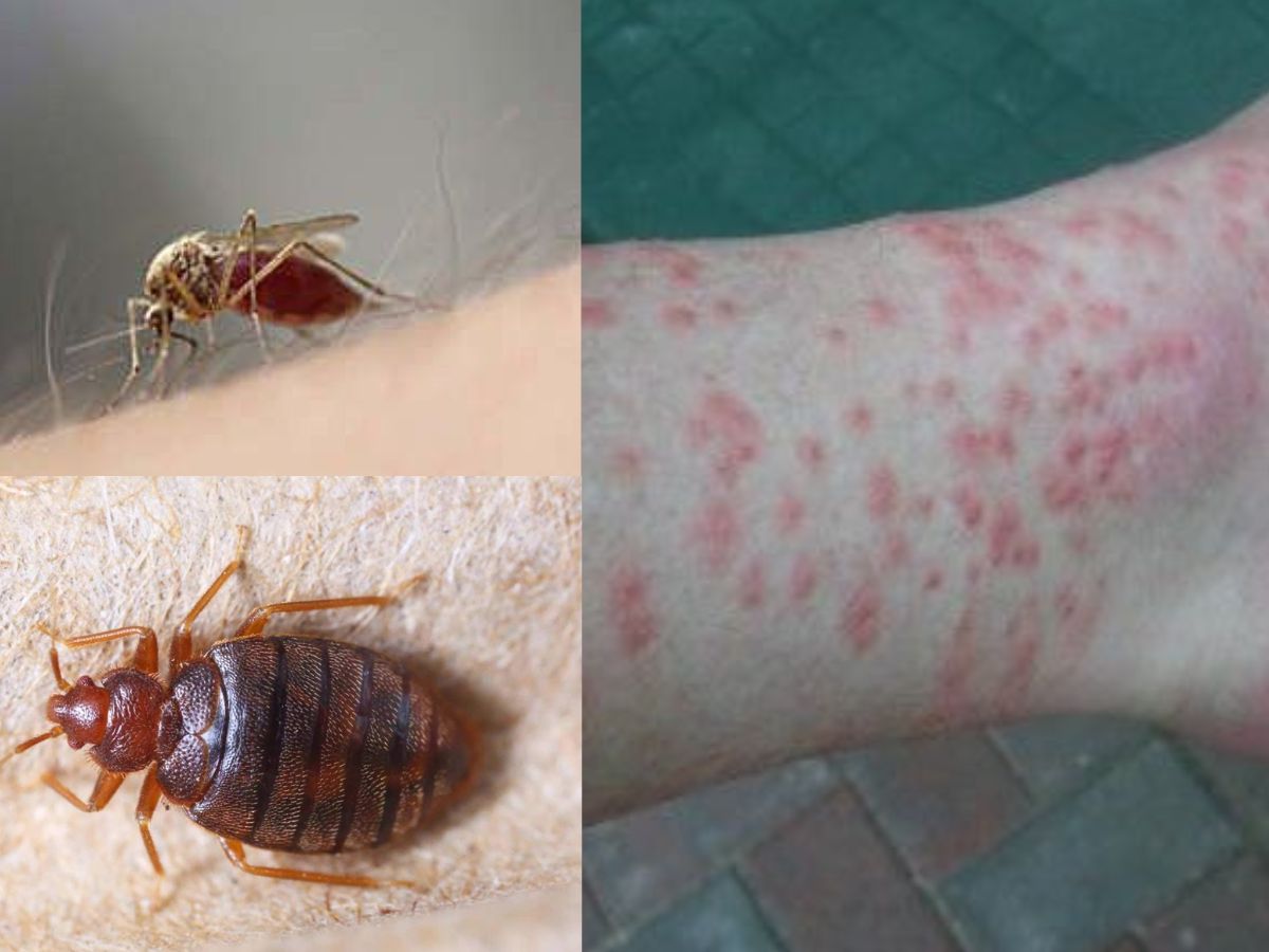 viral illness like chikungunya - Photo Gallery