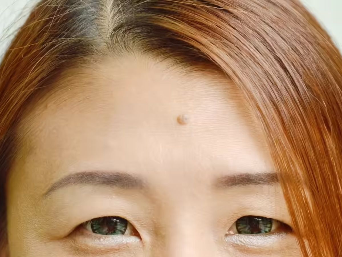 हाथ, नाक-आंख या शरीर के कौन-से हिस्से पर तिल होना है शुभ और राजयोग की निशानी? - Photo Gallery