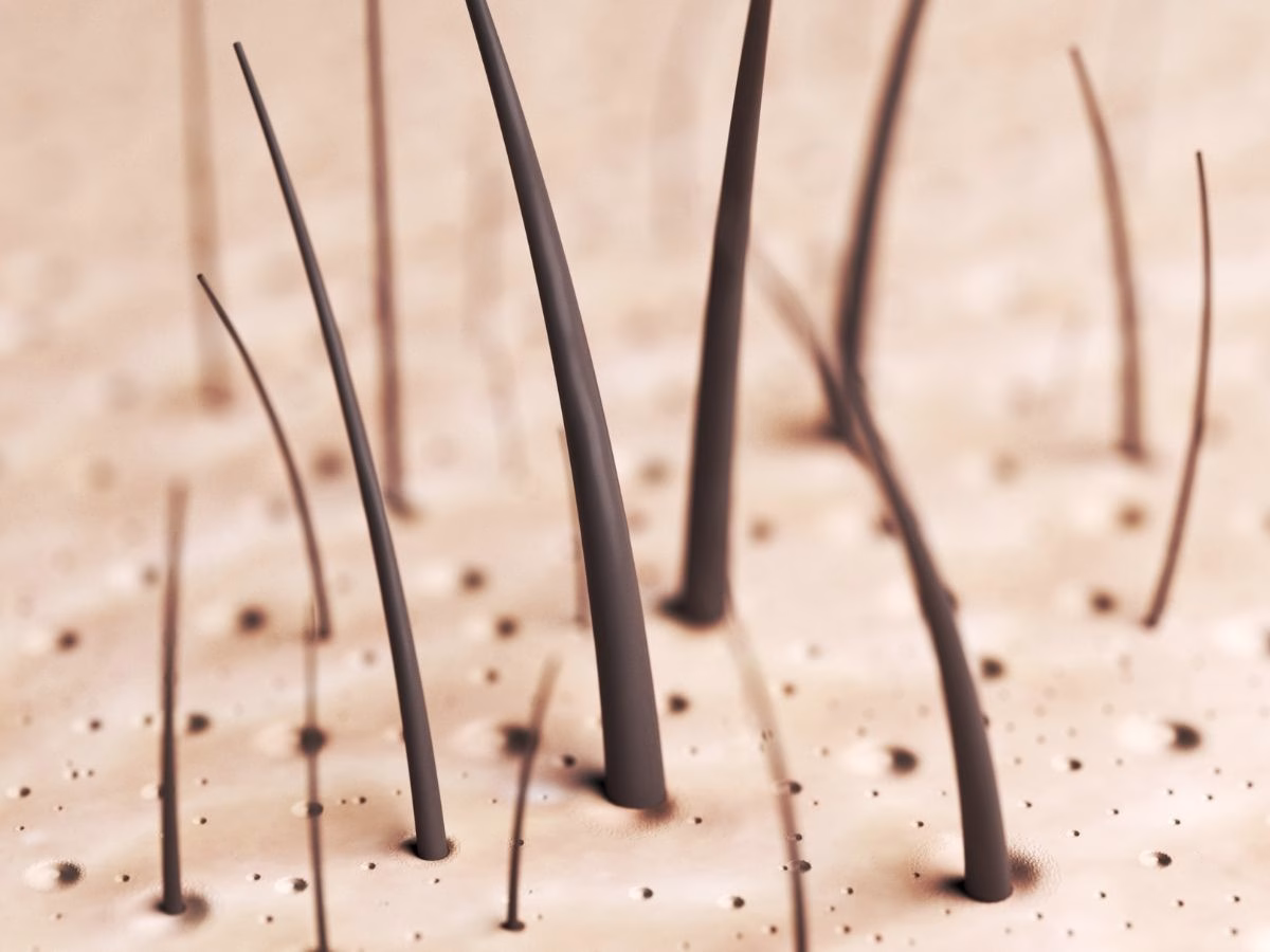 केवल 20 दिन में उग सकेंगे असली बाल, वैज्ञानिकों ने खोज लिया गजब का सीरम; अब गंजे भी मार सकेंगे बालों के साथ स्टाइल! - Photo Gallery