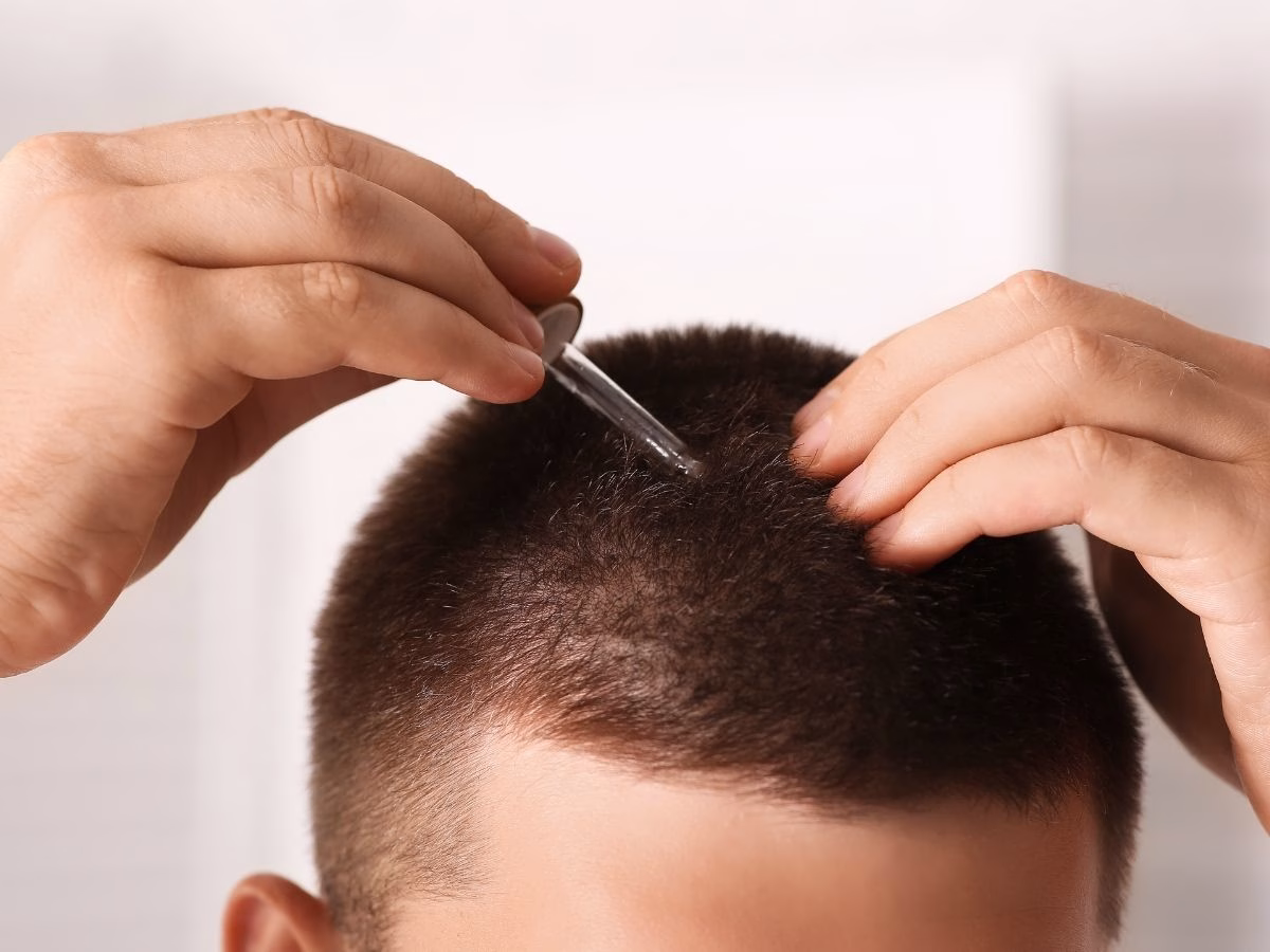 केवल 20 दिन में उग सकेंगे असली बाल, वैज्ञानिकों ने खोज लिया गजब का सीरम; अब गंजे भी मार सकेंगे बालों के साथ स्टाइल! - Photo Gallery