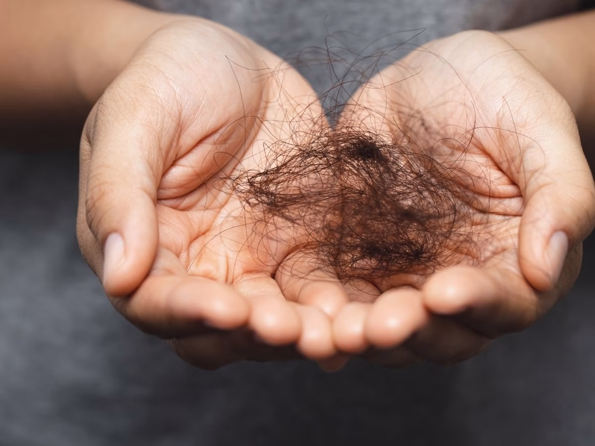 केवल 20 दिन में उग सकेंगे असली बाल, वैज्ञानिकों ने खोज लिया गजब का सीरम; अब गंजे भी मार सकेंगे बालों के साथ स्टाइल! - Photo Gallery