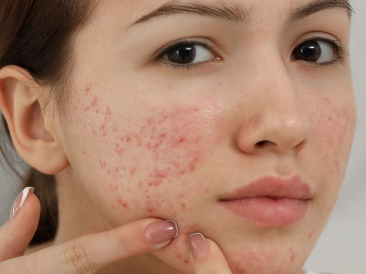 मेकअप हटाए बिना सोती हैं? जानें आपकी त्वचा पर छिपा खतरनाक सच! - Photo Gallery