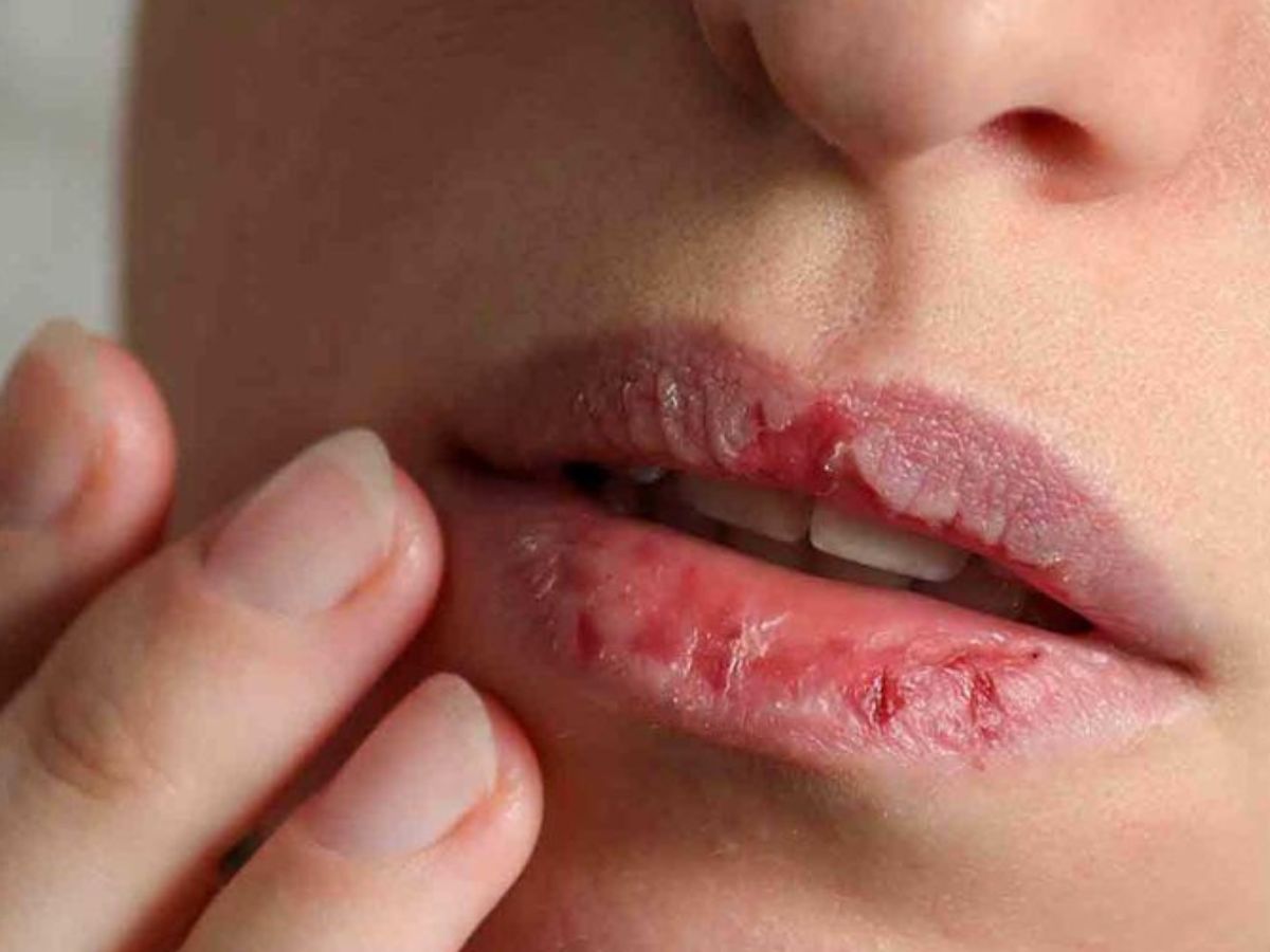 मेकअप हटाए बिना सोती हैं? जानें आपकी त्वचा पर छिपा खतरनाक सच! - Photo Gallery