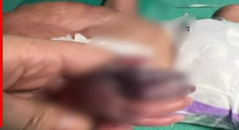 UP News: डॉक्टर की लापरवाही ने मासूम को दिया जीवनभर का दर्द! करतूत जानकर दहल जाएगा आपका भी दिल