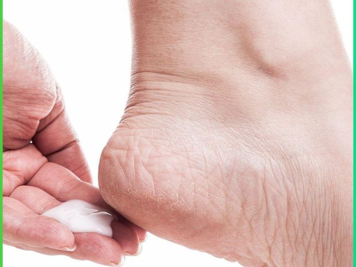 Cracked Heels Remedies At Home: फटी एड़ियों का इलाज घर पर ही! जानें सबसे असरदार घरेलू नुस्खे - Photo Gallery
