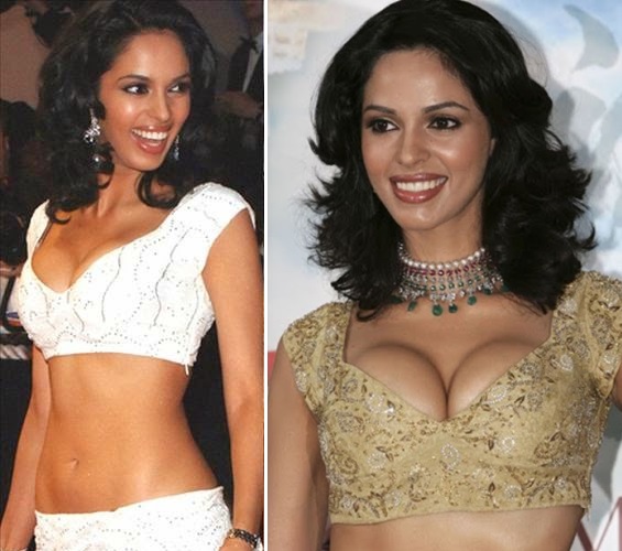 राखी सावंत ने 16 की उम्र में करवाई थी ब्रेस्ट सर्जरी, इन एक्ट्रेसेस ने भी परफेक्ट फिगर के लिए करवाए इम्प्लांट