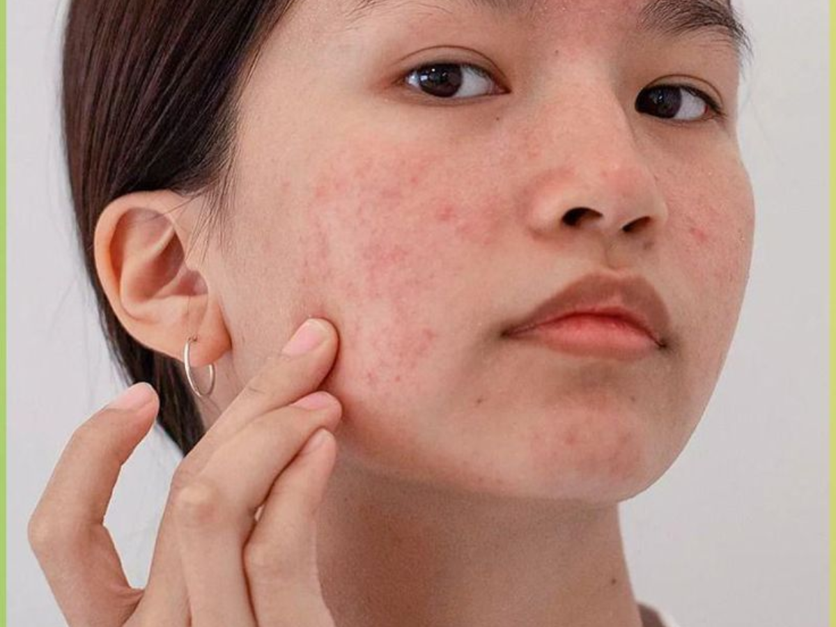 skin inflammation - Photo Gallery