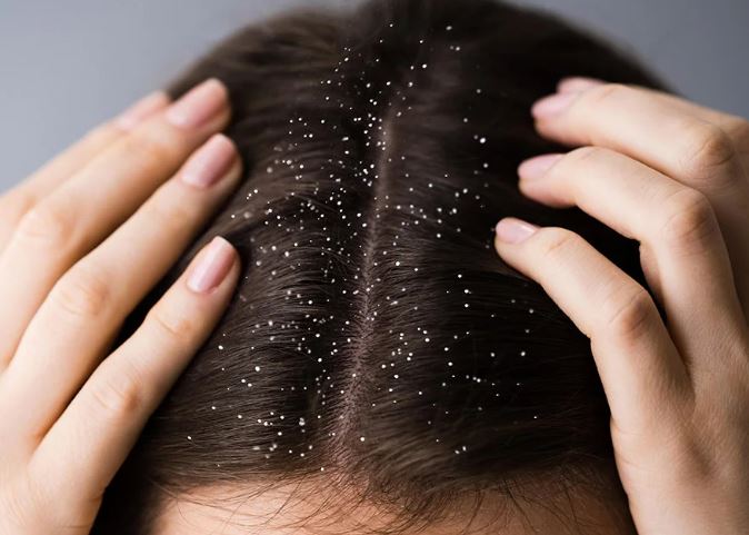 Risk of scalp problem - Photo Gallery
