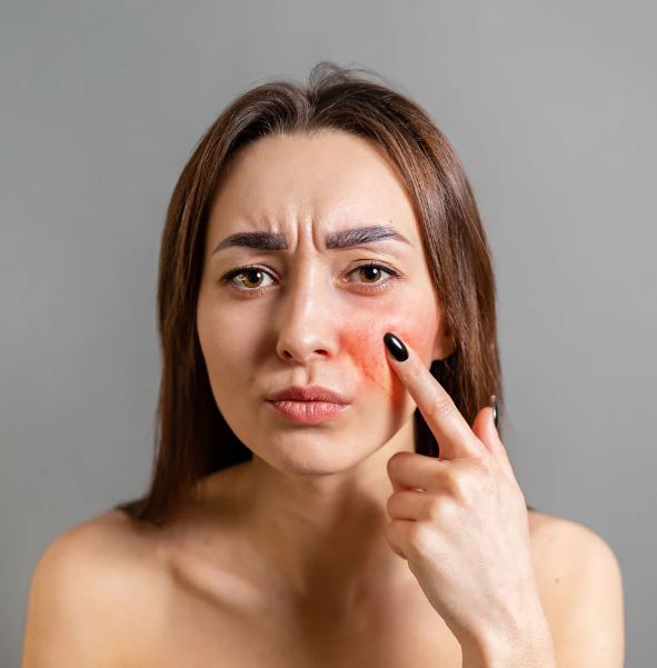 Expecting immediate results - Photo Gallery