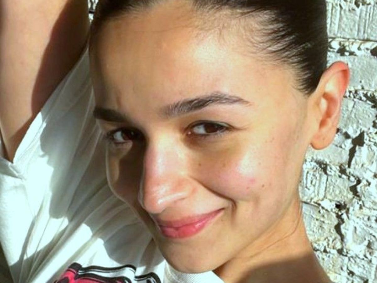 alia bhatt skin - Photo Gallery