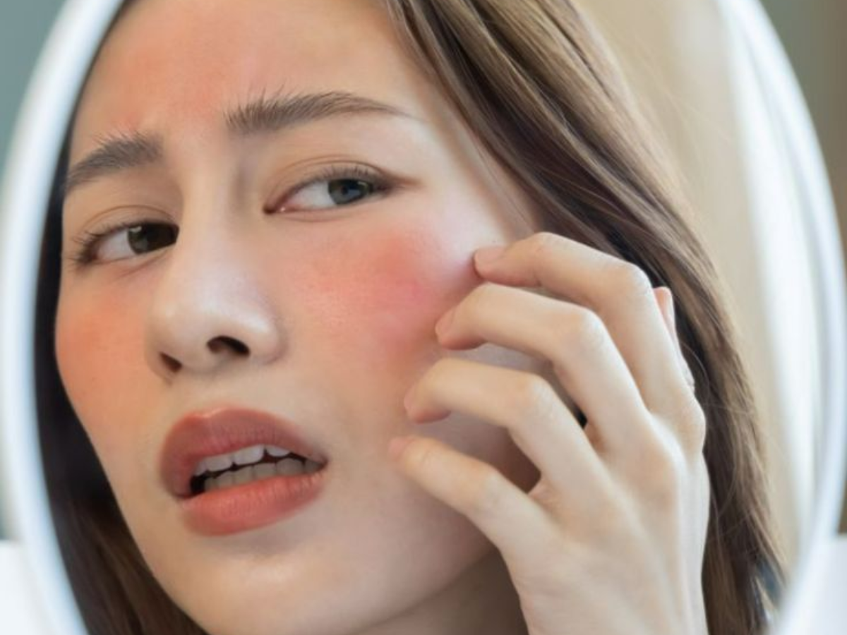 skin allergy - Photo Gallery