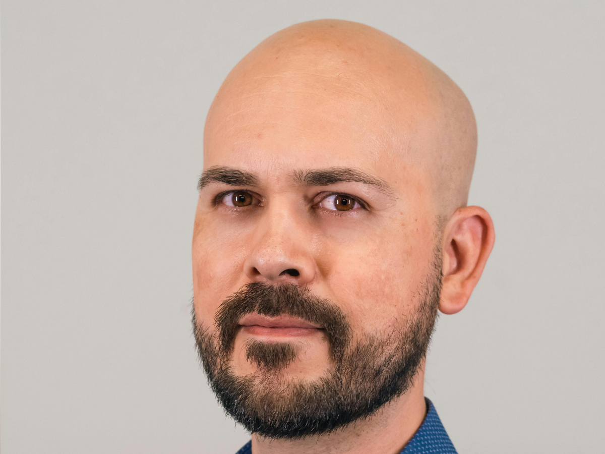 टॉप 10 सबसे ज़्यादा गंजे पुरुषों वाले देश, जानिए भारत की क्या है रैंकिंग? - Photo Gallery