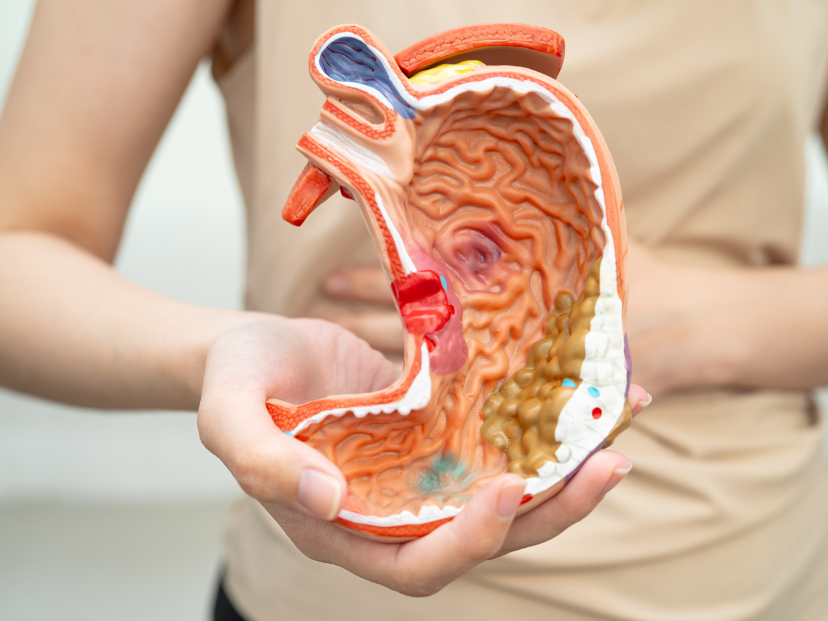 गैस या बदहजमी नहीं, हो सकता है पेट का कैंसर! इन लगातार दिखने वाले लक्षणों को भूलकर भी न करें नजरअंदाज - Photo Gallery