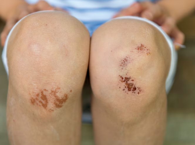 Old injuries are not healing - Photo Gallery