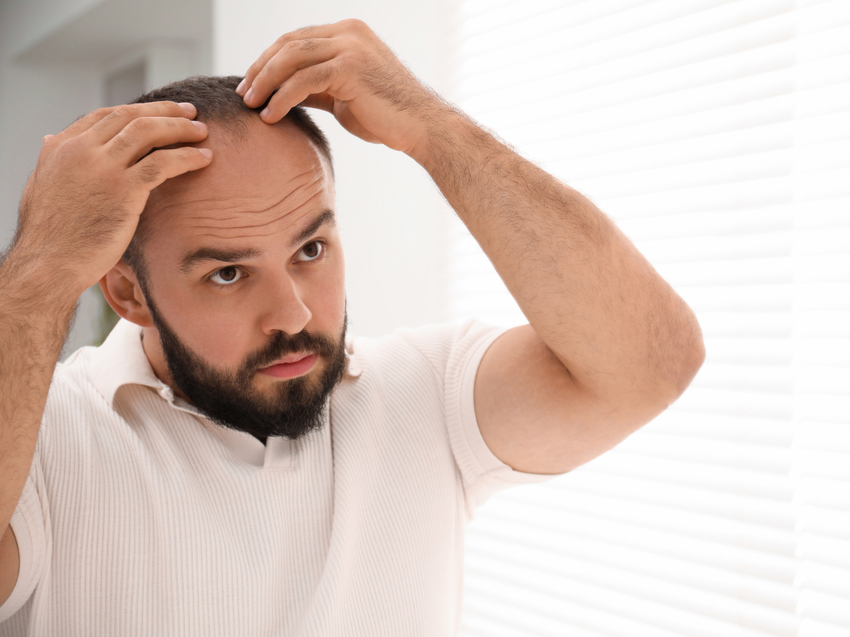 टॉप 10 सबसे ज़्यादा गंजे पुरुषों वाले देश, जानिए भारत की क्या है रैंकिंग? - Photo Gallery