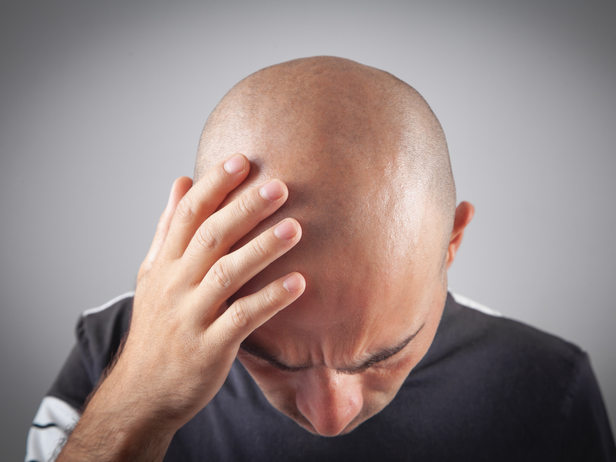 टॉप 10 सबसे ज़्यादा गंजे पुरुषों वाले देश, जानिए भारत की क्या है रैंकिंग? - Photo Gallery