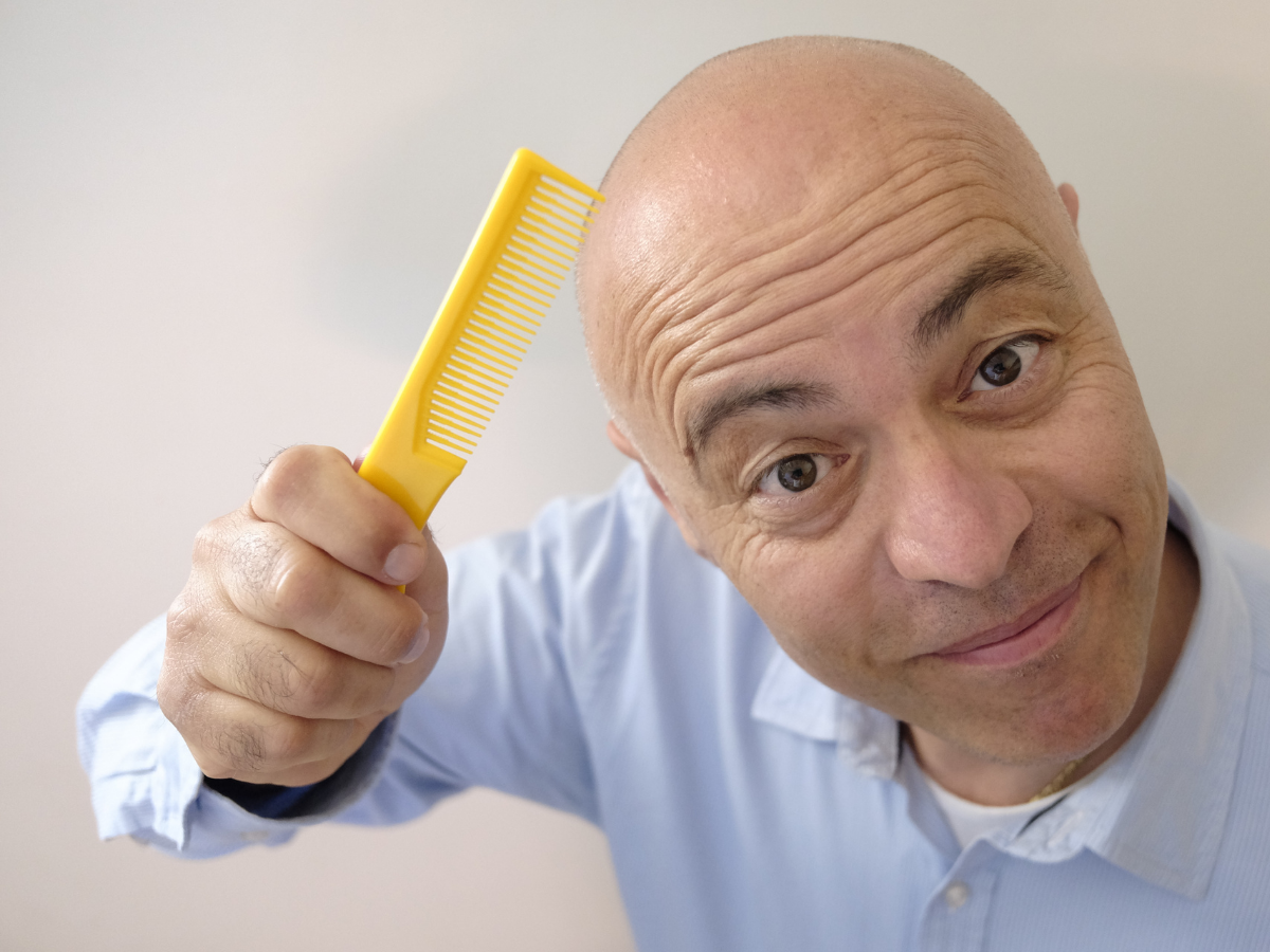 टॉप 10 सबसे ज़्यादा गंजे पुरुषों वाले देश, जानिए भारत की क्या है रैंकिंग? - Photo Gallery