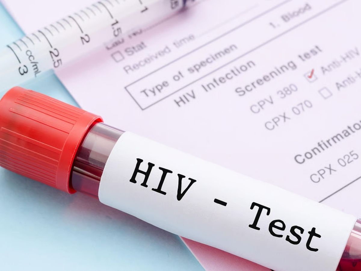 HIV The disease was found to be under control in 75 of patients - Photo Gallery