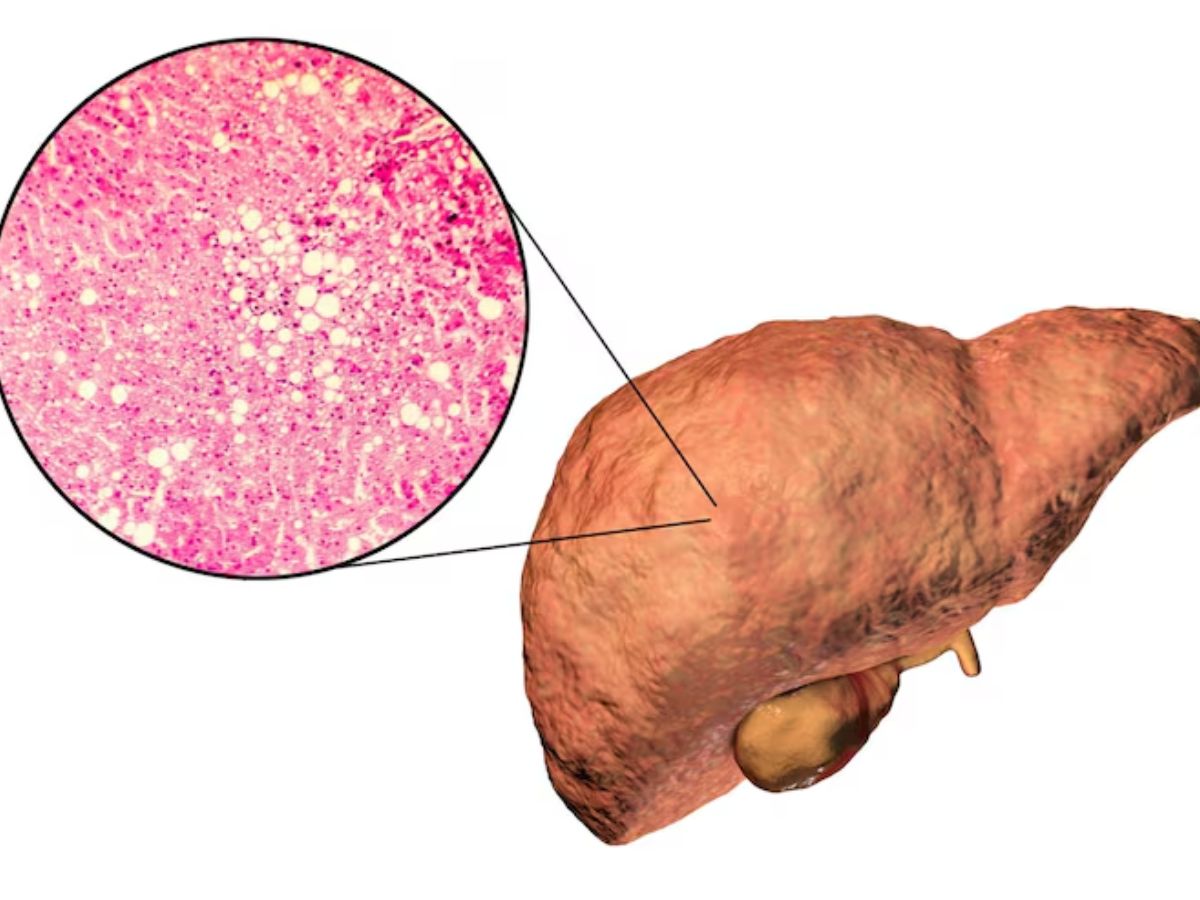 sugar 5 - Photo Gallery