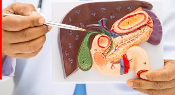 दक्षिण एशियाई लोगों में फैटी लिवर क्यों बढ़ रहा है? डॉक्टर ने बताईं रोज़मर्रा की तीन बड़ी गलतियां और सुझाव