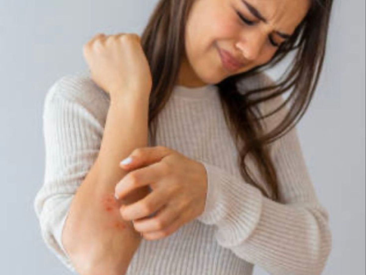 सर्दियों में वूलेन पहनने के बाद आपको भी सताती है खुजली, यह हो सकती है वजह - Photo Gallery