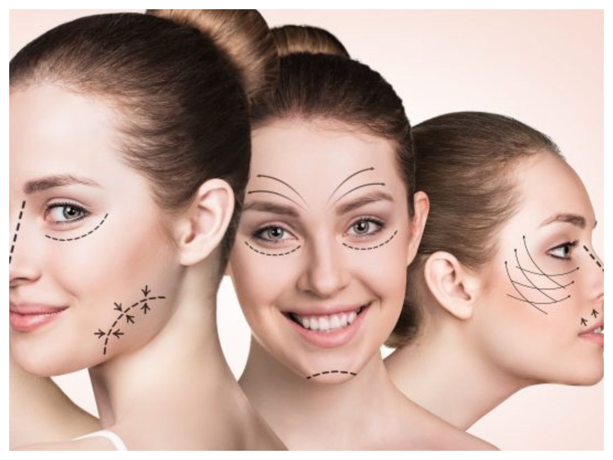 Plastic Surgery Risk: प्लास्टिक सर्जरी के कुछ दिनों बाद बियांका डियास की मौत,क्या ये सर्जरी है जानलेवा? - Photo Gallery