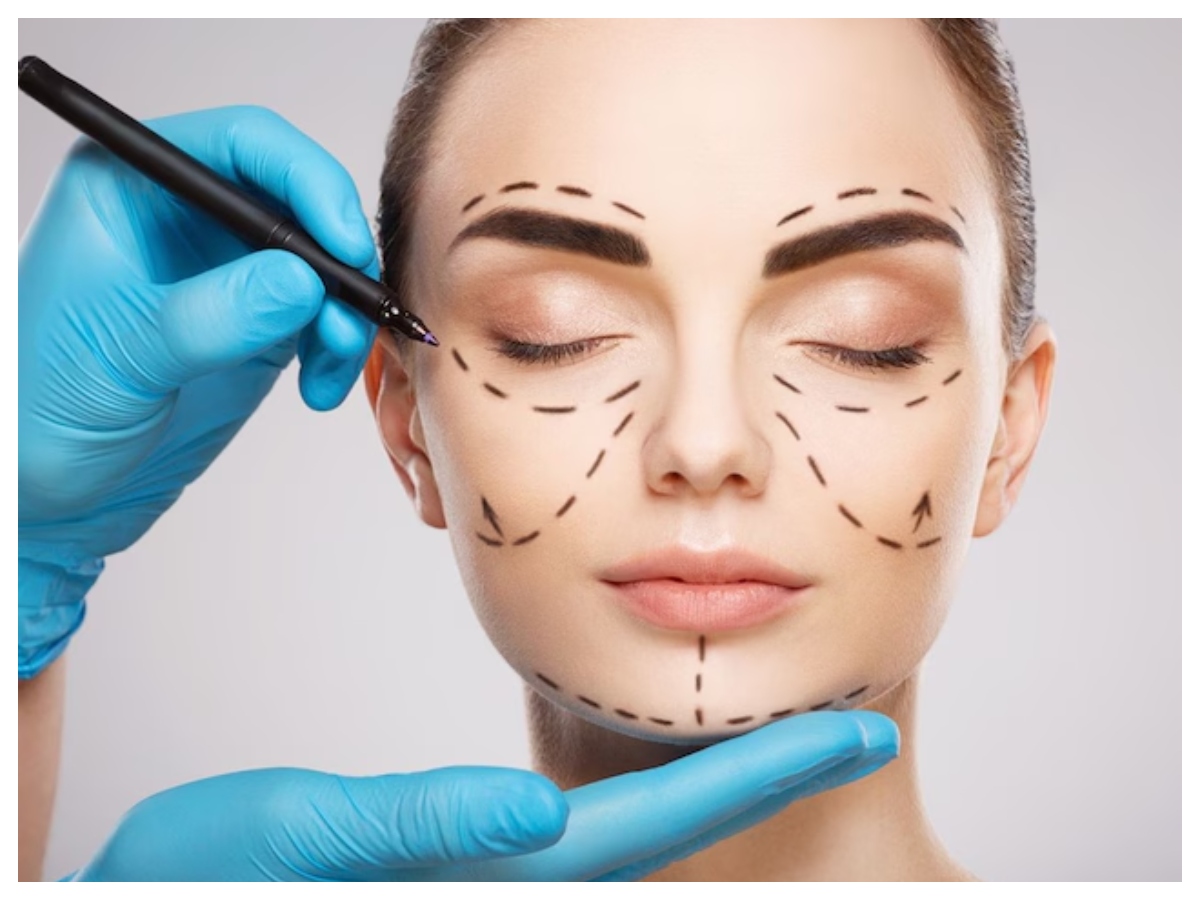 Plastic Surgery Risk: प्लास्टिक सर्जरी के कुछ दिनों बाद बियांका डियास की मौत,क्या ये सर्जरी है जानलेवा? - Photo Gallery