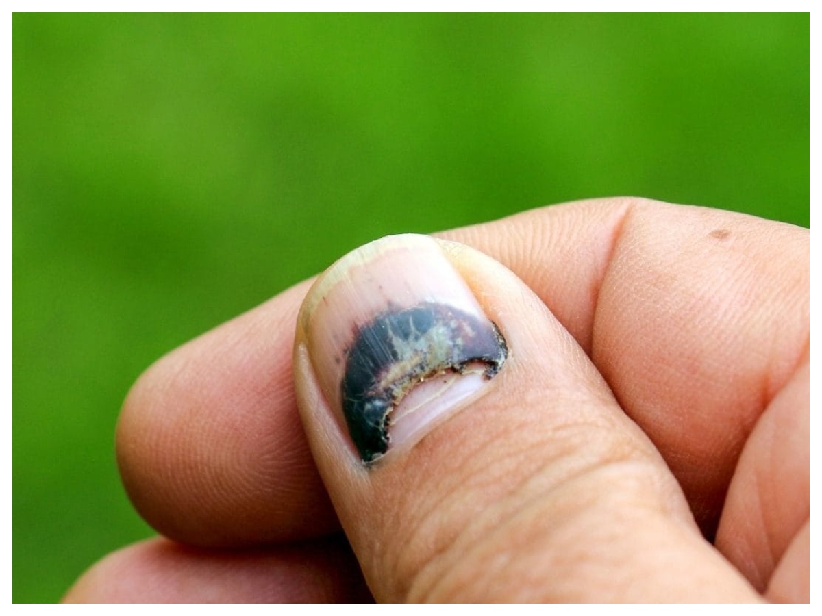 Nail health: नाखूनों में दिख रहे ये बदलाव? हो सकती है गंभीर बीमारी की चेतावनी - Photo Gallery