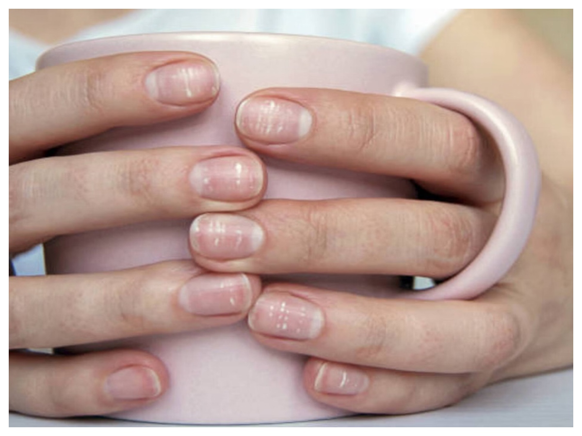 Nail health: नाखूनों में दिख रहे ये बदलाव? हो सकती है गंभीर बीमारी की चेतावनी - Photo Gallery