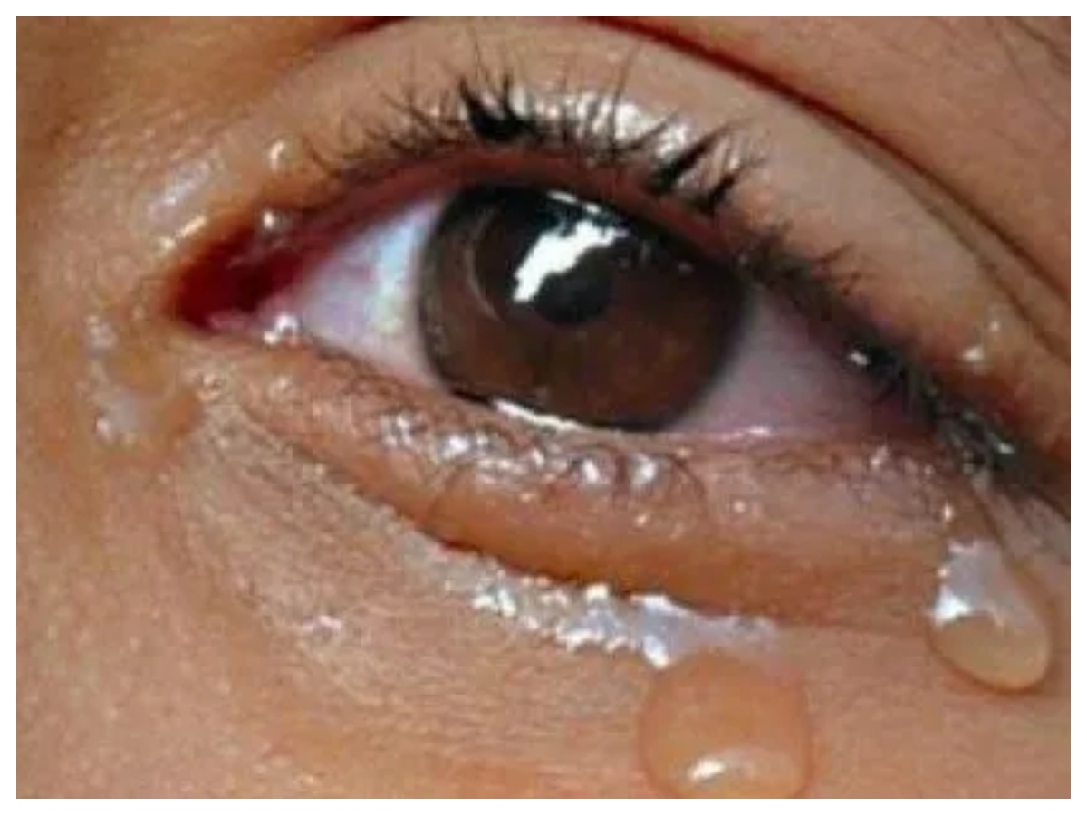 emotional tears: क्यों आते हैं आंसू? जानिए इमोशंस और रोने के पीछे का विज्ञान - Photo Gallery