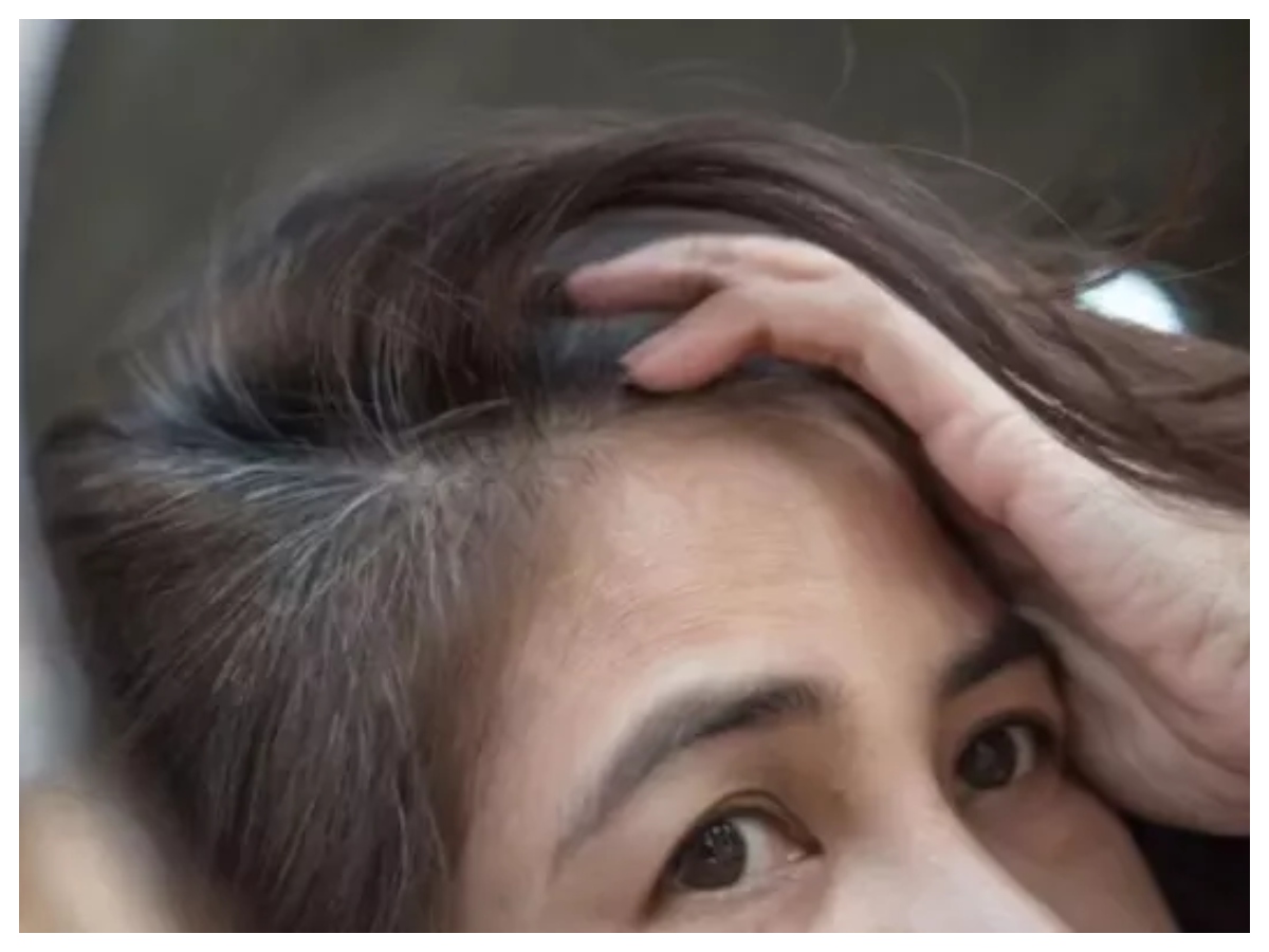 Hair problems: समय से पहले सफेद हो रहे हैं बाल? सही देखभाल से रोकें सफेदी,अपनाएं ये आसान उपाय - Photo Gallery