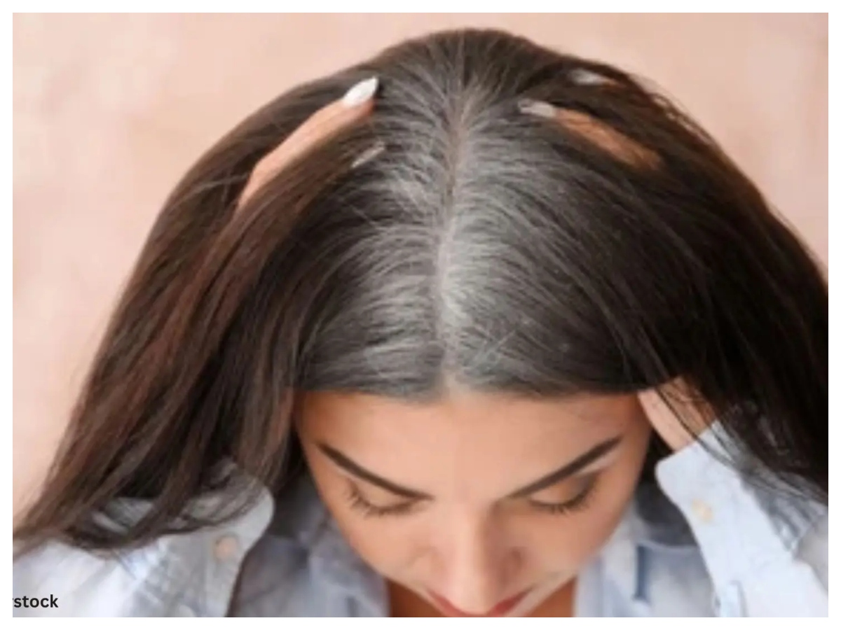 Hair problems: समय से पहले सफेद हो रहे हैं बाल? सही देखभाल से रोकें सफेदी,अपनाएं ये आसान उपाय - Photo Gallery